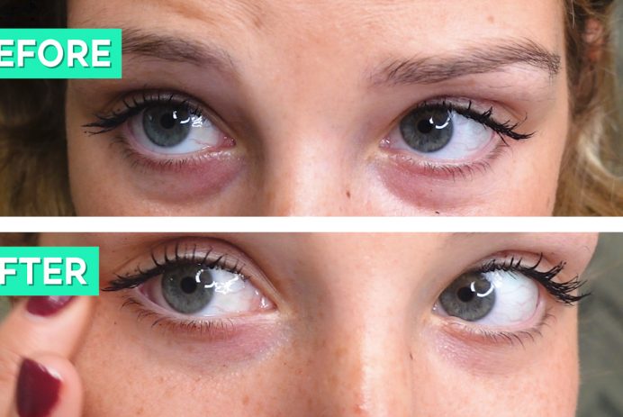 DIY Coffee Eye Mask - Brighten Dark Circles and Soothe Puffiness