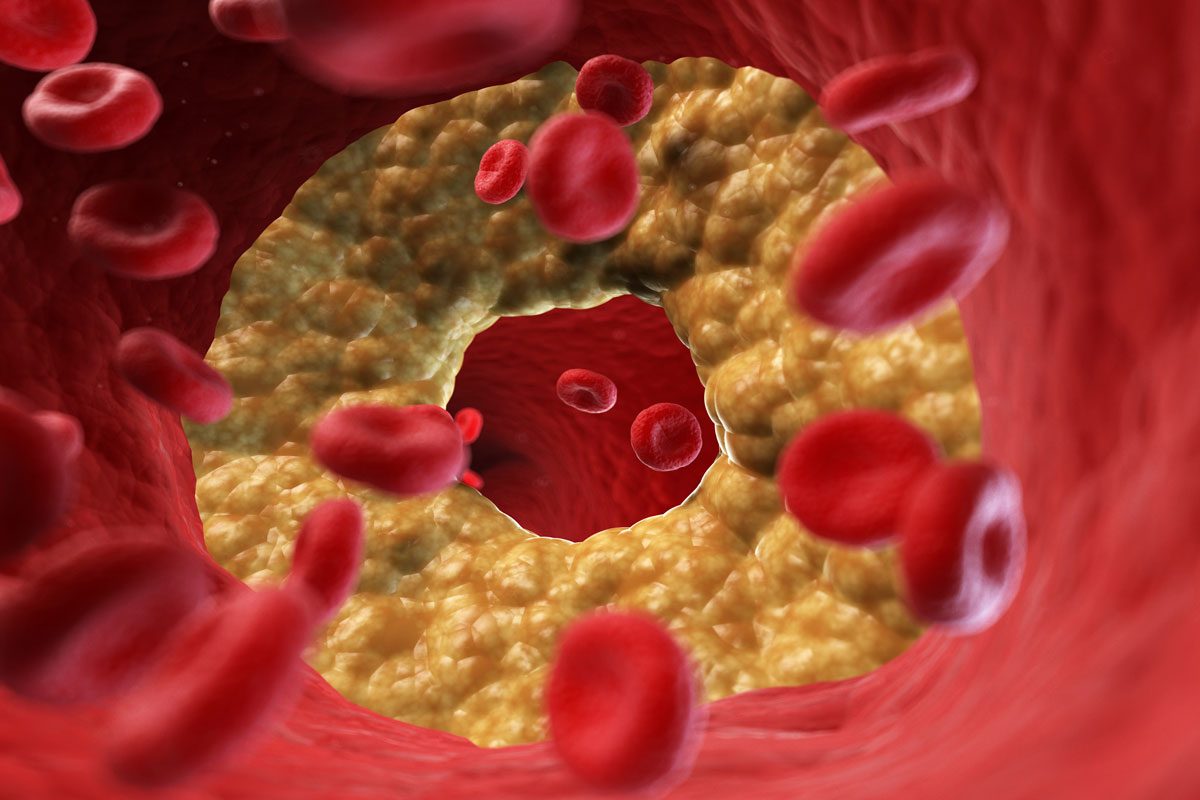 Coffee Choices - How Your Machine Affects Cholesterol Levels